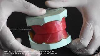 Preclinical Prosthodontics Fabrication of Mandibular occlusal rim  step by step [upl. by Kimberlyn]