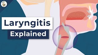 Why Do You Lose Your Voice  Laryngitis Explained [upl. by Eoin]