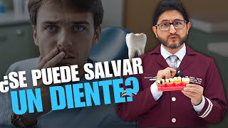 ¿Se Puede Salvar un Diente Todo lo que Debes Saber 🦷 [upl. by Retluoc]