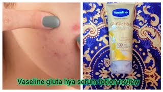 Vaseline gluta hya serum lotion review [upl. by Enyleve]