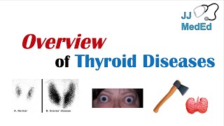 Overview of Thyroid Diseases Hashimoto’s Graves’ Sick Euthyroid Syndrome Toxic adenoma etc [upl. by Slaughter]