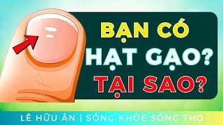 Bạn có những ĐỐM TRẮNG HẠT GẠO trên móng tay không Thiếu Chất Gì  đi cùng Giải Pháp Tự Nhiên [upl. by Bautram]