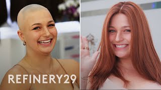 Styling Wigs With Alopecia  Hair Me Out  Refinery29 [upl. by Nylemaj919]