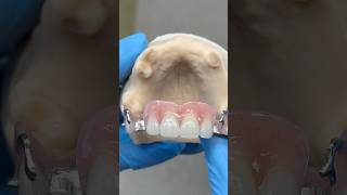 Upper Chrome Cobalt Partial ​⁠EnvisiontecMain envisiontec lsk121shorts dentist dentistteeth [upl. by Terrel819]