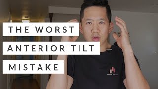 The worst anterior pelvic tilt mistake everyone makes [upl. by Gianina51]