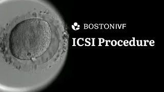 ICSI Procedure Explained  Science at Boston IVF [upl. by Euqinad]