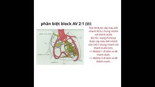 ECG AV Block 21  mobitz 1 or mobitz 2 [upl. by Helen941]