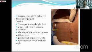 Intercostal nerve block indications contraindications techniques  Dr Susmit Naskar [upl. by Nylidnam]