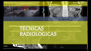 Técnicas Radiológicas Tórax [upl. by Peh755]