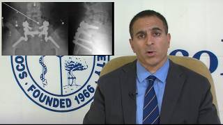 SRS Patient Video Spondylolisthesis  Ron ElHarwary MD [upl. by Jammin531]