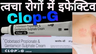 CLOPG Cream Uses in Hindi  Clobetasol Propionate amp Gentamicin Sulphate Cream [upl. by Ishii]