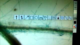 GUS Assay and root microscopy [upl. by Bouton71]