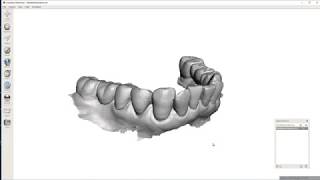 MeshMixer Dental  Repairing Missing Data [upl. by Nivrek348]