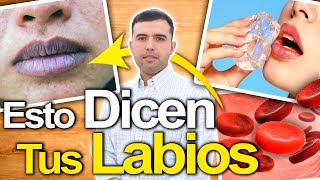 Esto Revelan Tus Labios  Enfermedades Que Muestran Tus Labios Y Cómo Solucionarlo [upl. by Solohcin521]