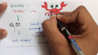 Lysosomal storage diseases mnemonic  USMLE  NEETPG  AIIMS [upl. by Aerehs860]