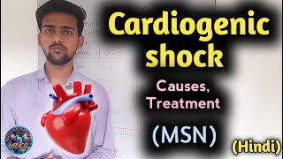 Cardiogenic shock  cardiogenic shock in hindi  cardiogenic shock nursing  MSN  medicalkagyan [upl. by Liberati]