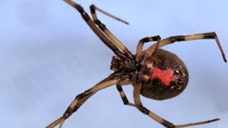 Brown Widow SpiderLatrodectus geometricusbite [upl. by Aidam261]