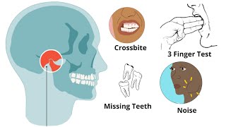 Is Your Jaw UNBALANCED  Uneven Jaw Causes Treatments MUST KNOW [upl. by Anilos]