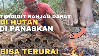 Wajib tau  Penanganan Pertama Ketika Tergigit Ular Berbisa di Hutan [upl. by Asilahs]