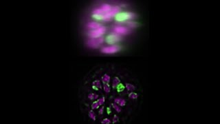 C elegans multiview deconvolution I [upl. by Ahsiuqat731]