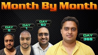 Hair Transplant Results Journey Month by Month [upl. by Alah277]