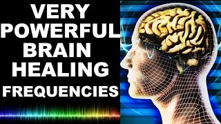 EXTREME BRAIN HEALING FREQUENCIES FOR STUDY FOCUS MIND POWER CONFIDENCE MEDITATION  MUST TRY [upl. by Noxaj211]