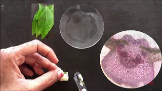 Adhatoda Vasaka Leaf  How to Do Section Cutting amp Microscopy of Vasaka Leaf  सेक्शन कटिंग ऑफ़ लीफ [upl. by Sparks]