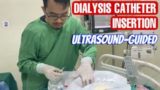 Dialysis catheter insertion  pemasangan CDL catheter double lumen [upl. by Olfe]