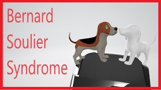 Bernard Soulier Syndrome [upl. by Weyermann]