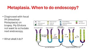 Metaplasia When to do endoscopy gastritis atrophic gastritis metaplasia dysplasia cancer [upl. by Eniladam811]