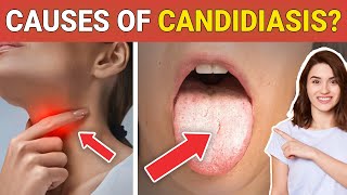 10 Shocking 😳 Causes of Candidiasis that you Might dont Know  Credihealth [upl. by Cyrus]