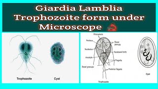 shorts  Giardia Lamblia Trophozoite in stool under Microscope 🔬 [upl. by Ennazzus]