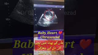 baby heart ultrasound  Dil ki dahrkan [upl. by Greyson]