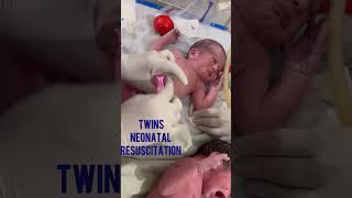 👩‍⚕️🤱How to do Twin’s neonatal resuscitationumbilical cord clamping and cuttingbaby resuscitation [upl. by Nymrak]