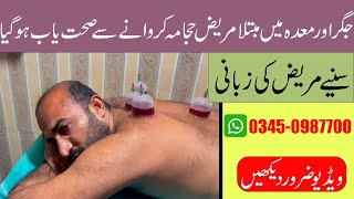 jigar or maday ka ilaj hijama se  Hijama Treatment  By Hakeem ObaidurRehman [upl. by Kinsley787]