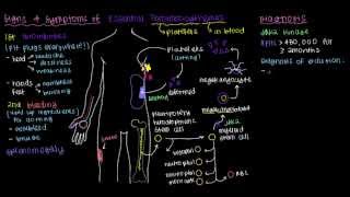 What is essential thrombocythemia [upl. by Iglesias]