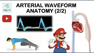 HOW TO FIX FAILED ARTERIAL LINE [upl. by Dhar]