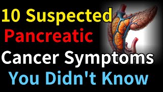 10 Suspected Pancreatic Cancer Symptoms You Didnt Know [upl. by Bravar]