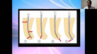 Endodontic Mishaps [upl. by Jake]