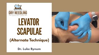 Dry Needling Levator Scapulae Alternate Technique [upl. by Ellwood]