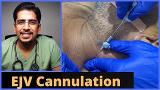 EJV External Jugular Vein Cannulation in 5 mins [upl. by Anawd]