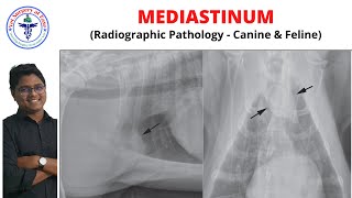 Mediastinum  Radiology  Lecture 13 [upl. by Ynabe]