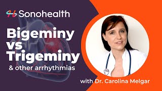 Bigeminy vs Trigeminy  PVCs amp Arrhythmias [upl. by Adnilreb896]