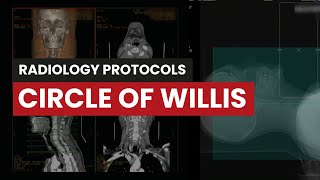 Computed Tomography Protocol Tutorial Circle of Willis [upl. by Sharia591]