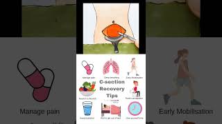 Csection recovery tips  Caesarean delivery pregnancy postdelivery pregnancyshorts [upl. by Einahpets]