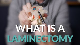 What is a Laminectomy  Spine Surgery Basics [upl. by Larry]