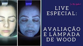 Live Especial Avaliação Com Lâmpada De Wood [upl. by Retsevel]