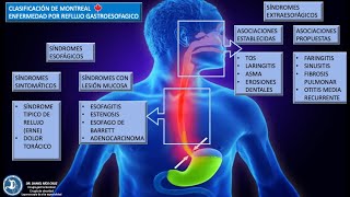 CLASIFICACION DE MONTREAL PARA REFLUJO GASTROESOFAGICO [upl. by Notnert]