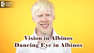 Vision problems in Albinos  Dancing Eyes in Albinos  Dr Sunita Rana Agarwal  Doctors Circle [upl. by Hewitt776]