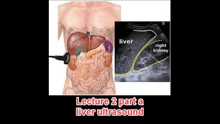 Abdominal ultrasound course  lecture 2 part a  liver د عمرو صلاح [upl. by Artek]